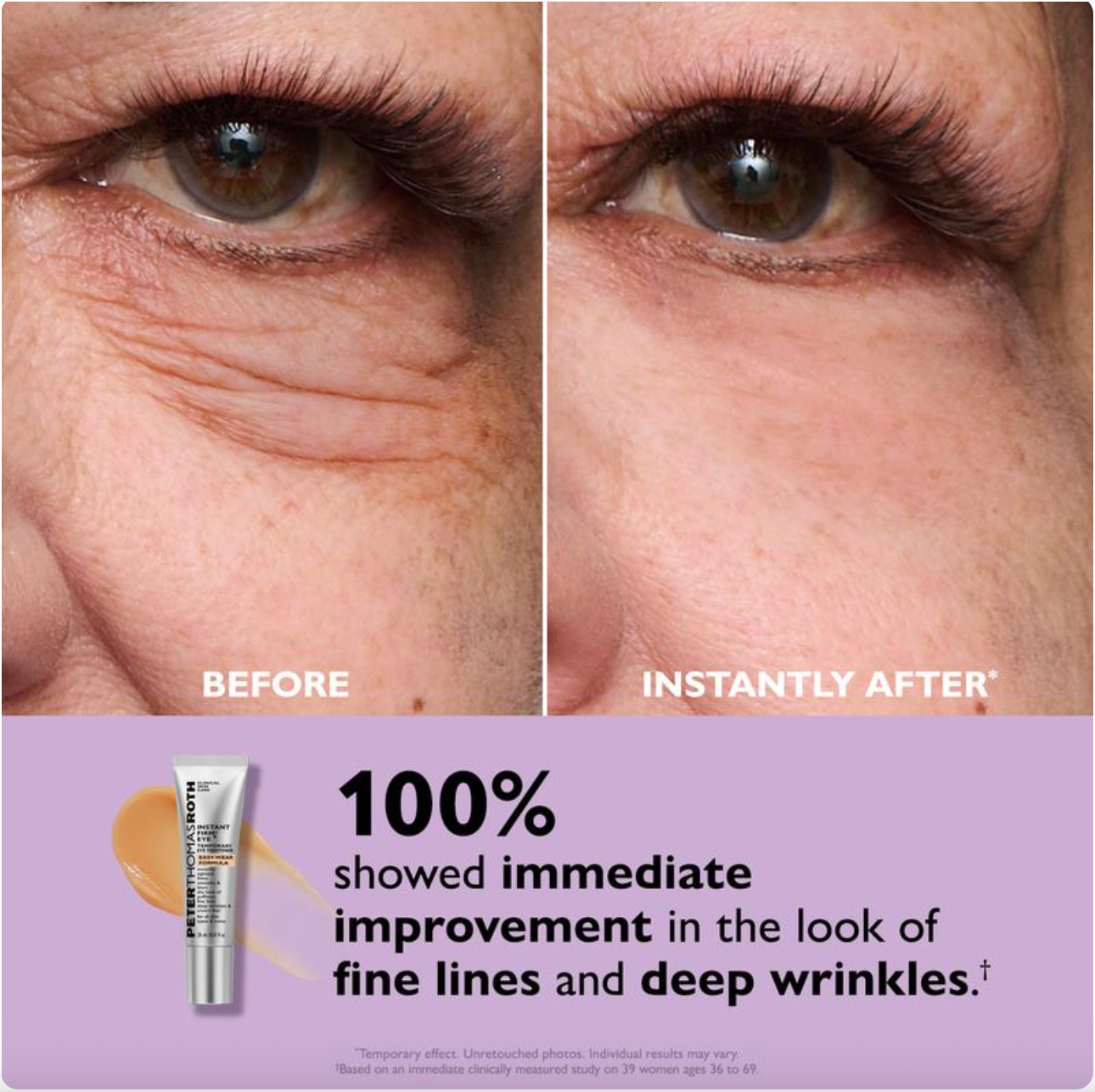 Instant FirmX Eye Tightener-Look Younger in Minutes