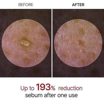 Dr. Melaxin Rice Peel Serum Ampoule™
