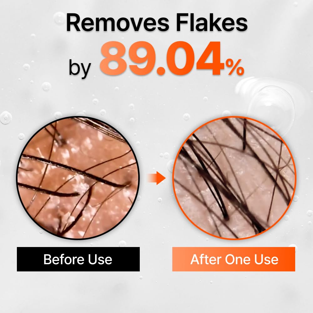 Hair Growth Serum with Exosome Technology — Scalp Ampoule - Cloffa