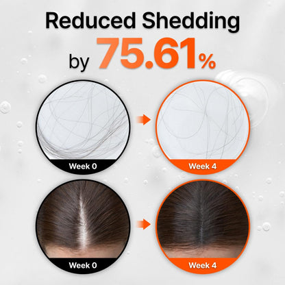 Hair Growth Serum with Exosome Technology — Scalp Ampoule - Cloffa