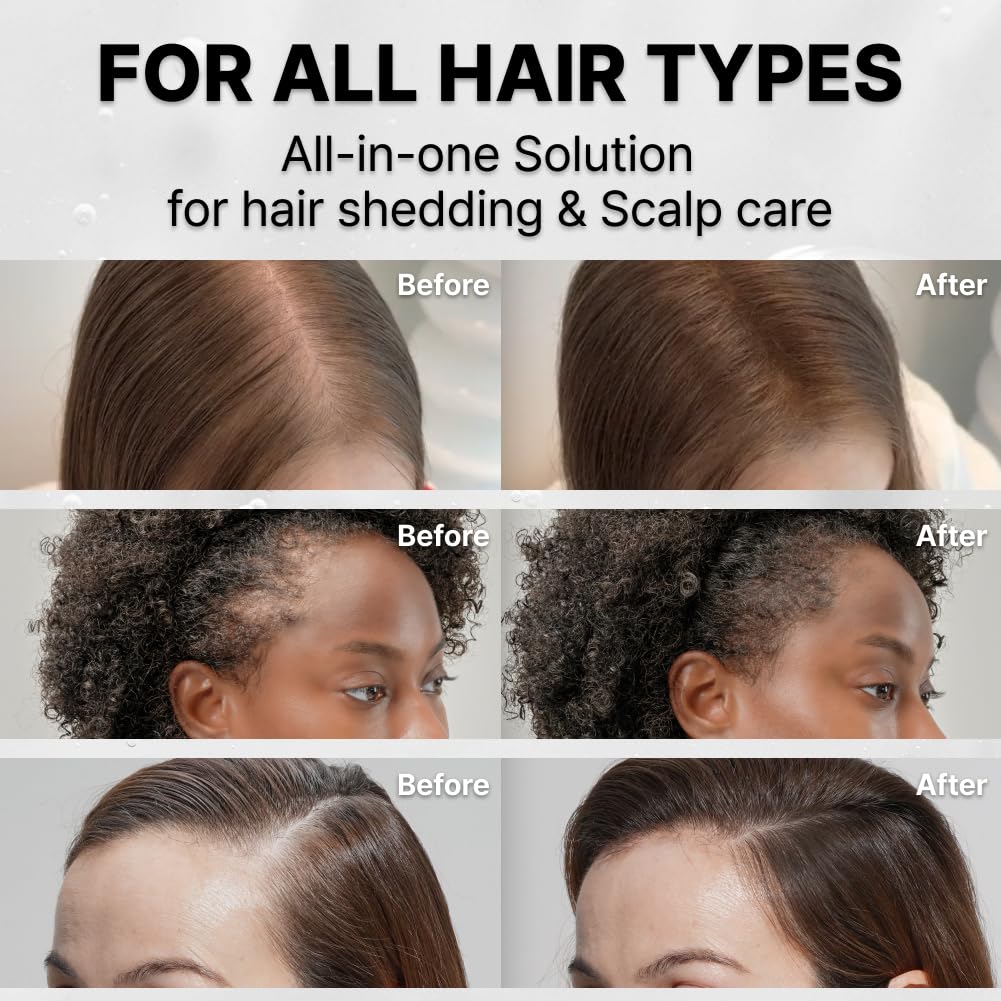 Hair Growth Serum with Exosome Technology — Scalp Ampoule - Cloffa