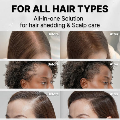 Hair Growth Serum with Exosome Technology — Scalp Ampoule - Cloffa