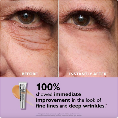 Instant FirmX Eye Tightener-Look Younger in Minutes