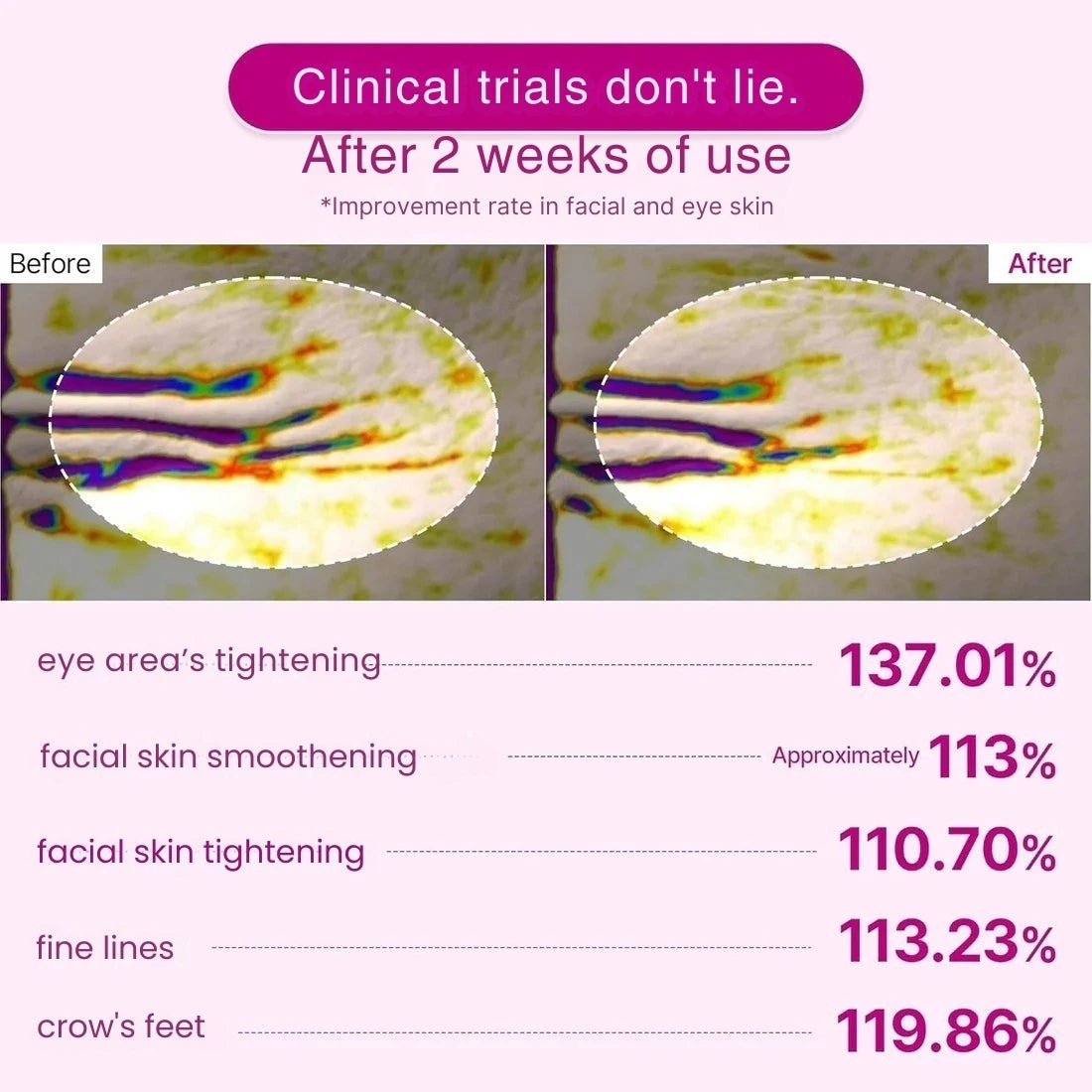 The Vita - A Retinal Shot Tightening Booster (15mL) - Cloffa
