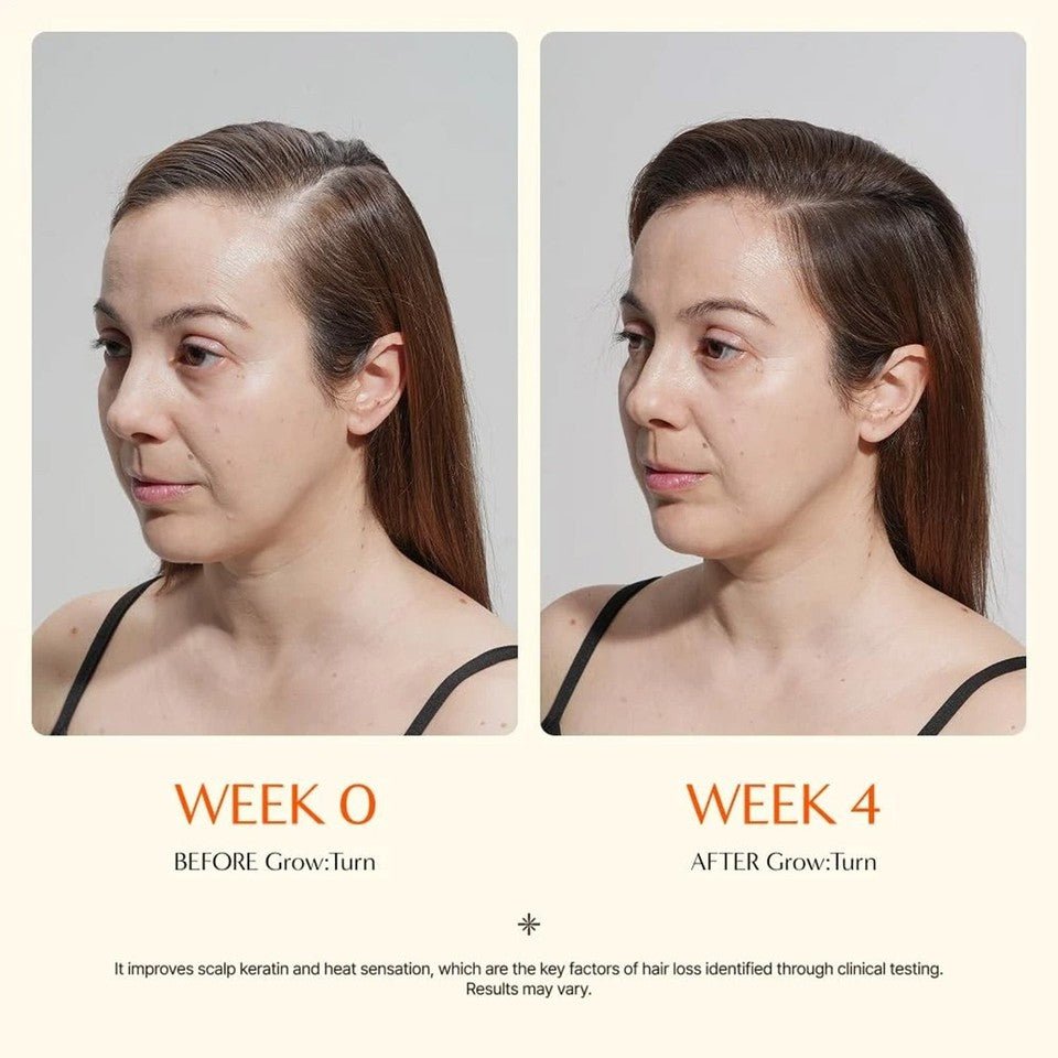 Hair Growth Serum with Exosome Technology — Scalp Ampoule - Cloffa