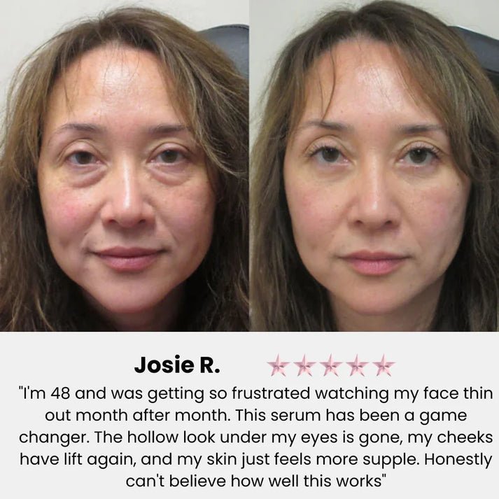Korean Volufiline® Collagen Serum – Plumps & Lifts Skin - Cloffa