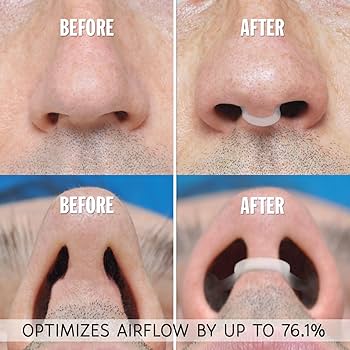 ZALUNAS Serene (Nasal): All 3 colours included - Cloffa